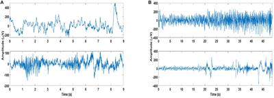 Comparison of Empirical Mode Decomposition, Wavelets, and Different Machine Learning Approaches for Patient-Specific Seizure Detection Using Signal-Derived Empirical Dictionary Approach